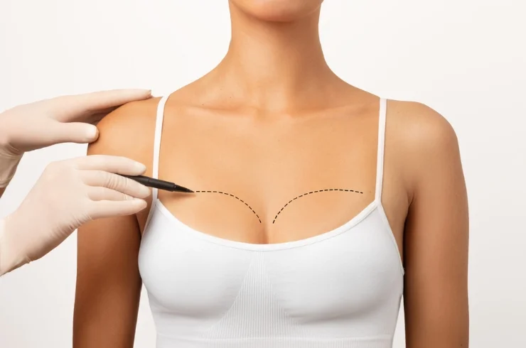 Breast Surgery