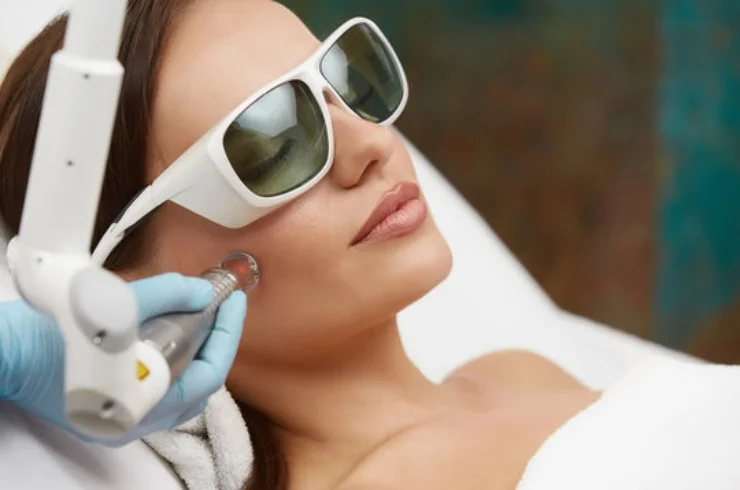 Laser Treatments