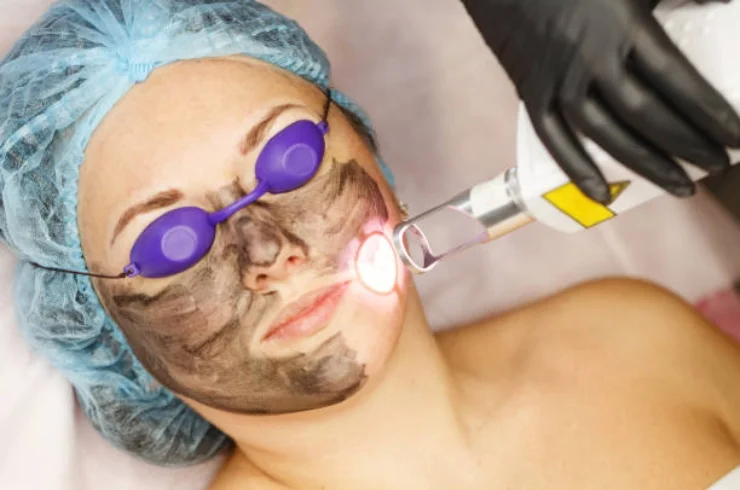 Laser Treatments