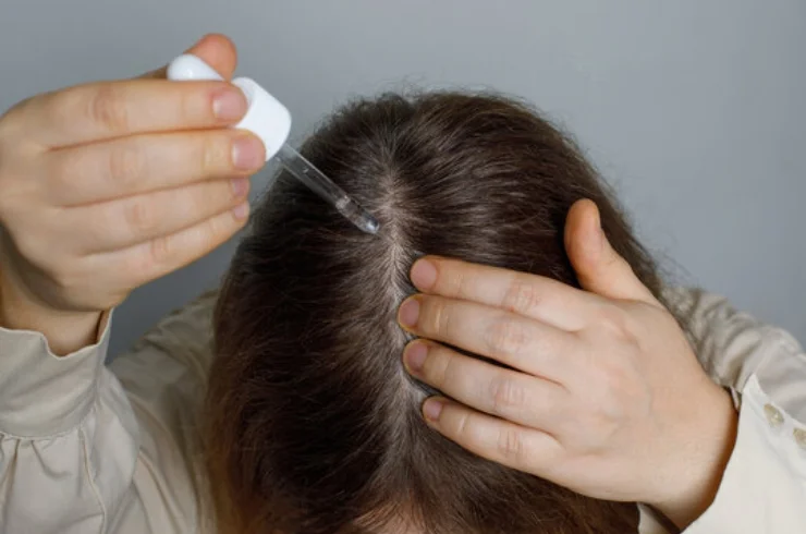 HAIR LOSS TREATMENT-----1