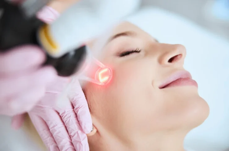 LASER FACIAL REJUVENATION-----1