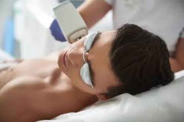 LASER FACIAL REJUVENATION-----3