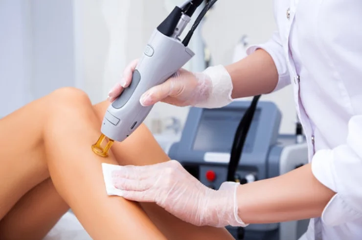 LASER HAIR REMOVAL-------1